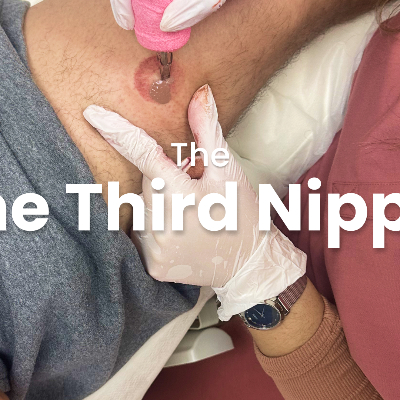 The Third Nipple