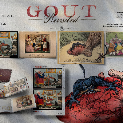 Gout Revisited